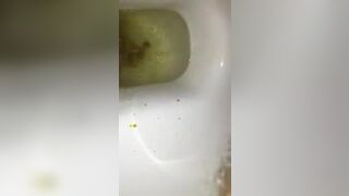Shitting Boys - Hairy boy massive diarrhea