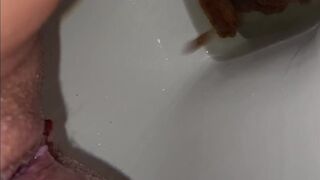 Dodgy tummy, ScatKings.com Scat Porn 18 ScatKings.com Scat Porn