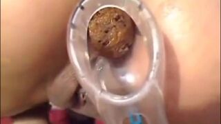 Girl Anal Speculum Shit, ScatKings.com Scat Porn 4 ScatKings.com Scat Porn